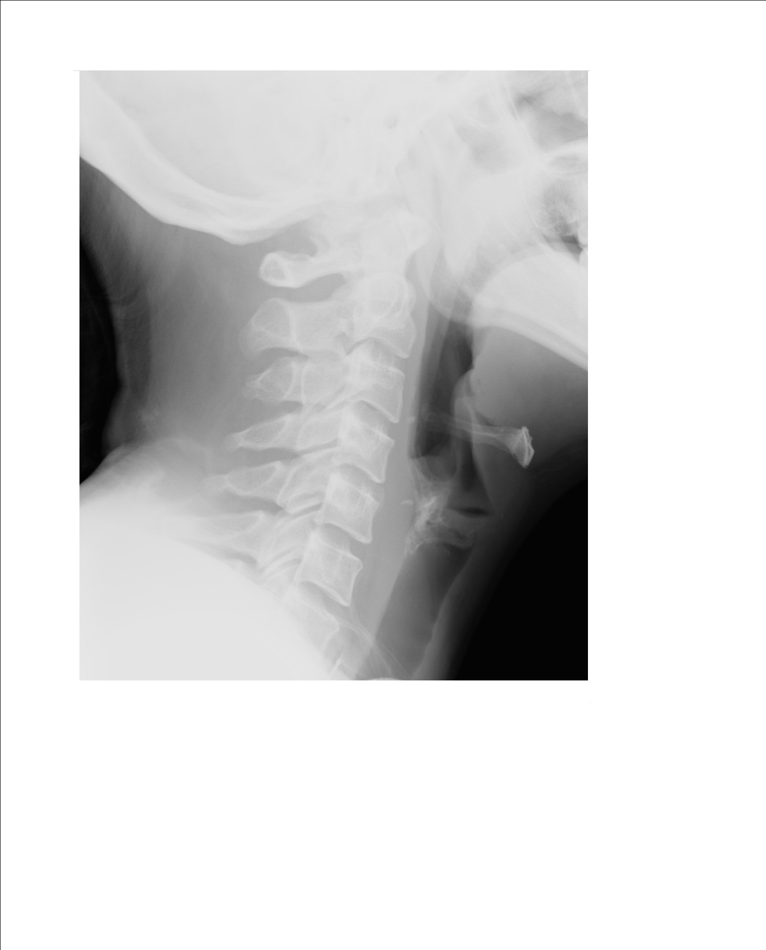 X Ray Neck